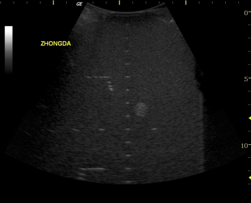 凸阵探头监测图